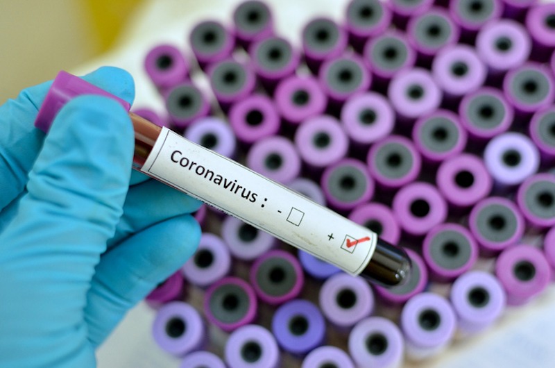 China Senior medical adviser" coronavirus pandemic 'over by june' if countries act